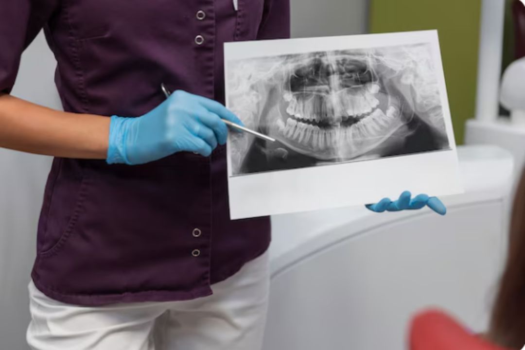 dental implant clinics in viman nagar pune